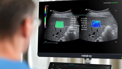 Comprehensive elastography