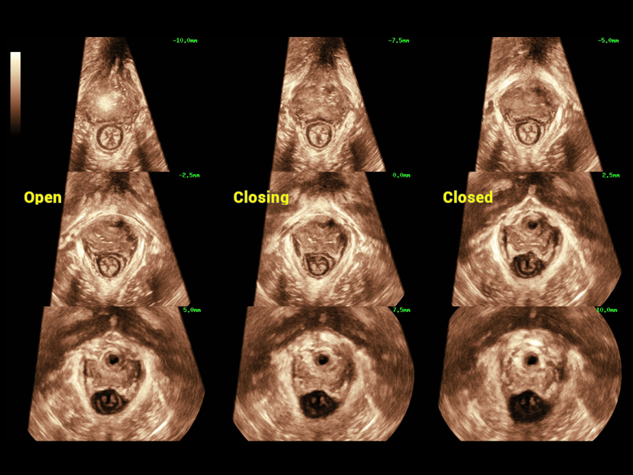 female-pelvic-fig1-3-pc