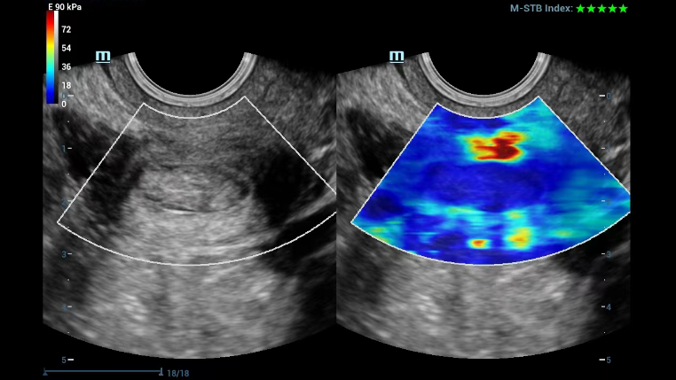 gynecology-fig2-pc