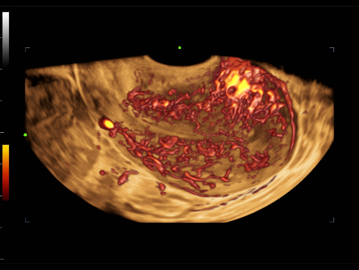 gynecology-fig3-2