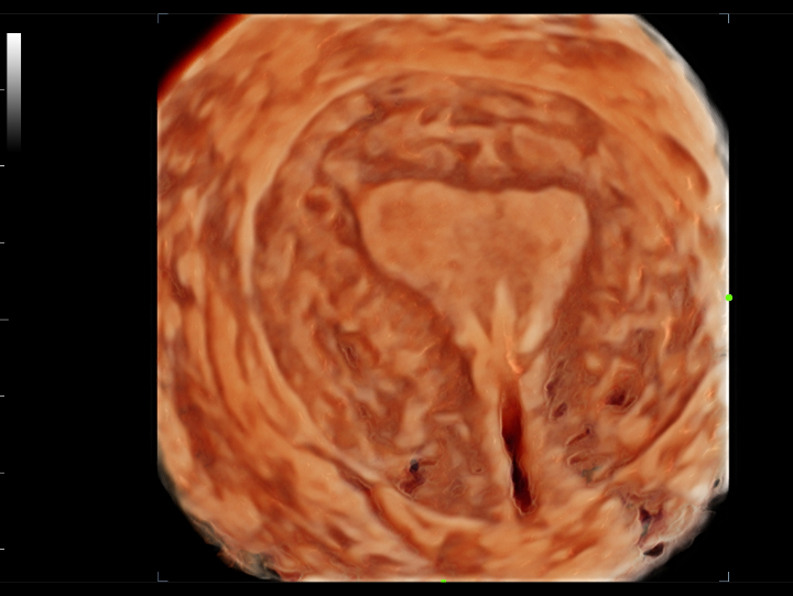 gynecology-fig3-3