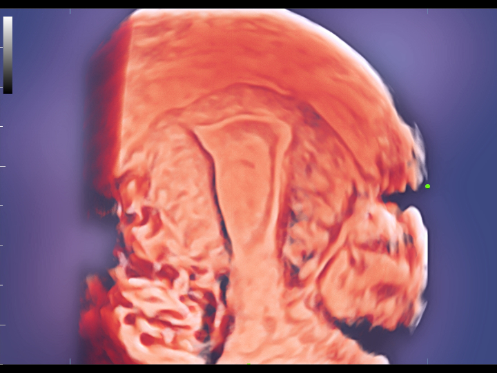 gynecology-fig3-4