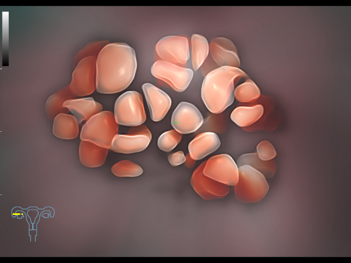 gynecology-fig3-7