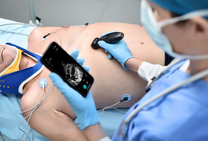 TE Air Wireless Handheld Ultrasound System