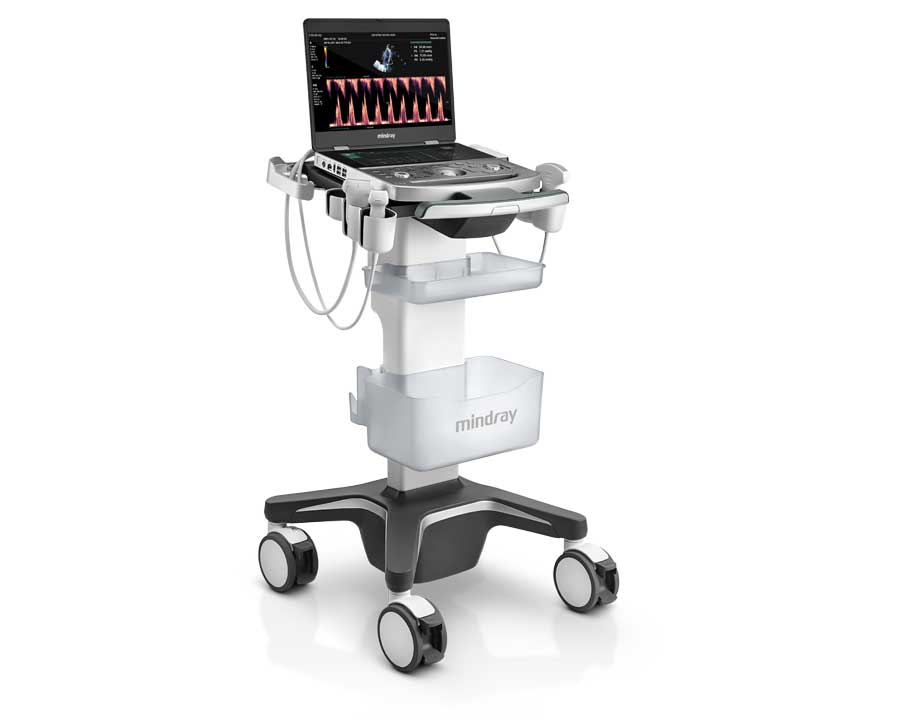 MX8 echocardiography cardiovascular imaging