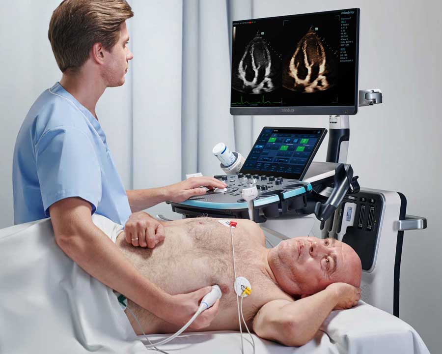 Resona 7 echocardiography cardio ultrasound