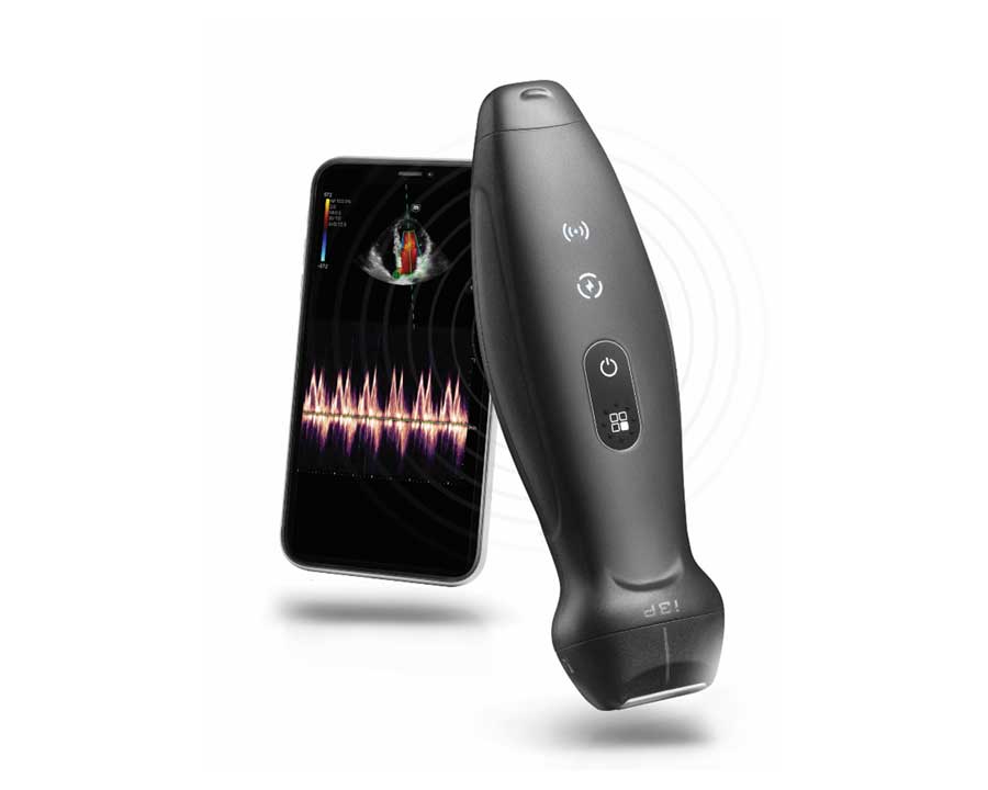 TE Air echocardiography handheld ultrasound