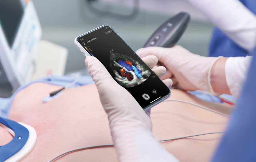 TE Air echocardiography pocket_sonogram