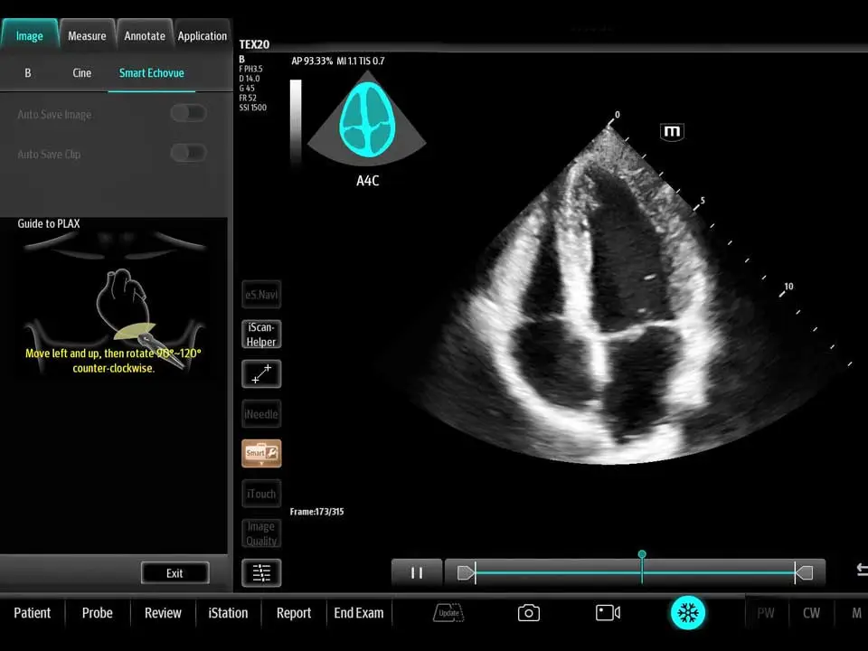 AI- Assisted Ultrasound Scanning 