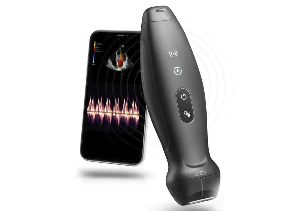 TE Air Wireless Handheld Ultrasound System 