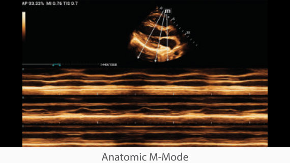 na-mx7-fig2-3