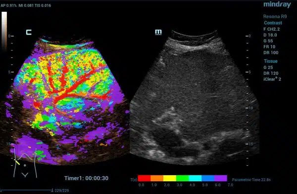 CEUS-CPM-600x393.jpg