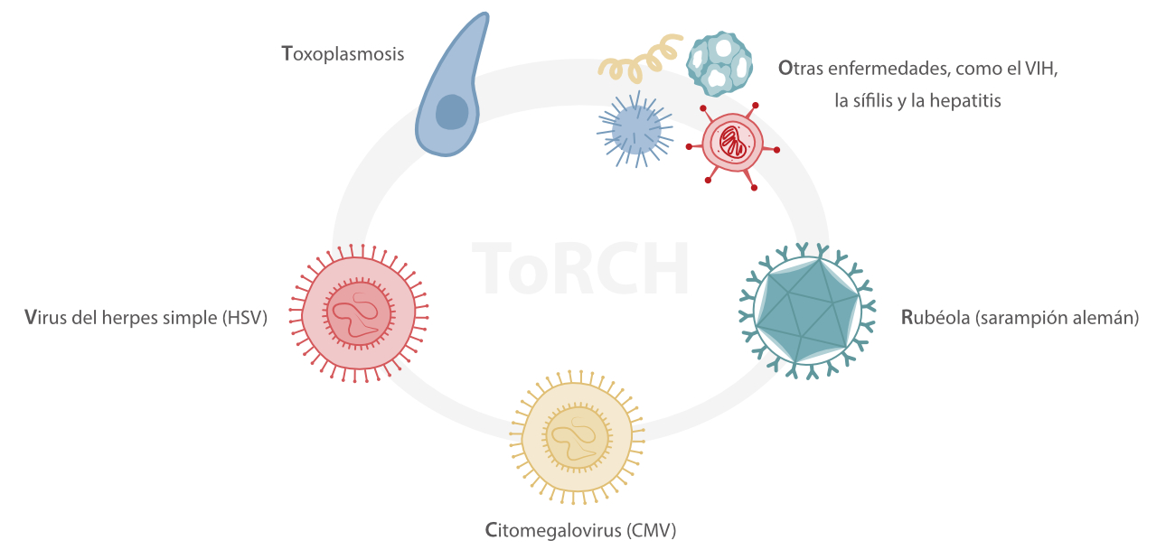 torch-panel-fig1-pc