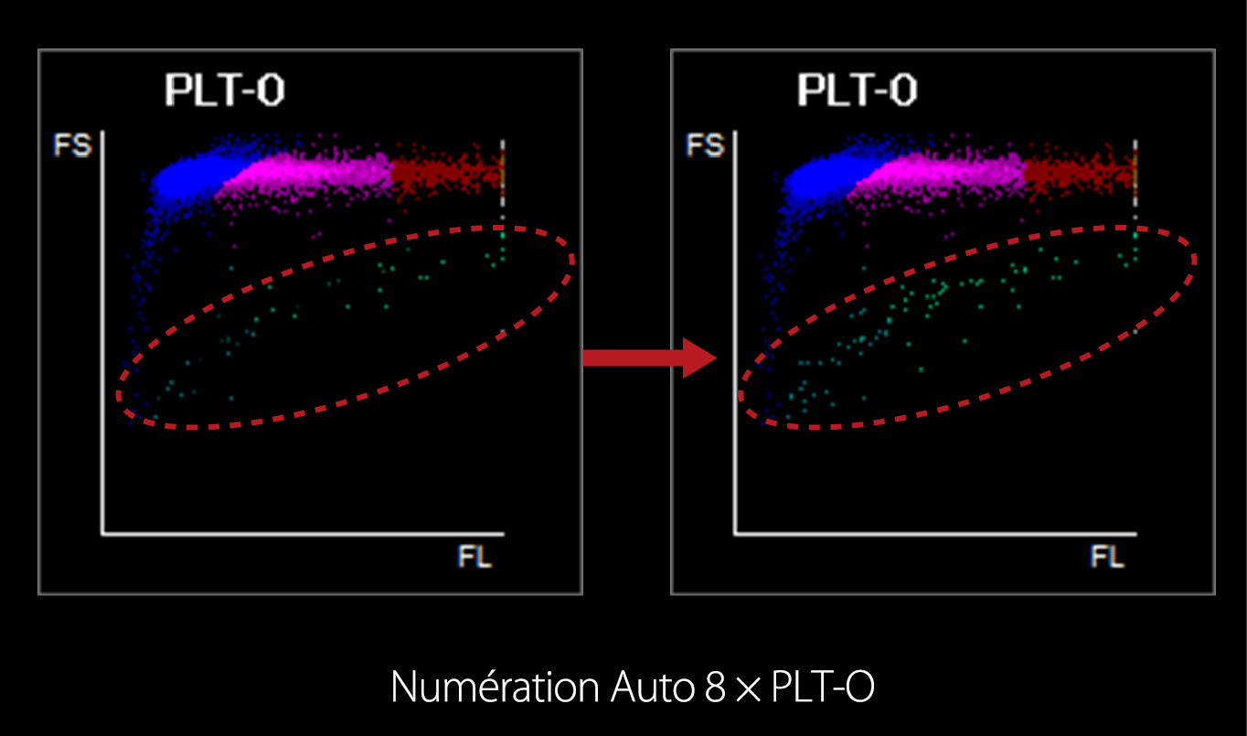 HemaBook Chapter3-PLT(1)_复制