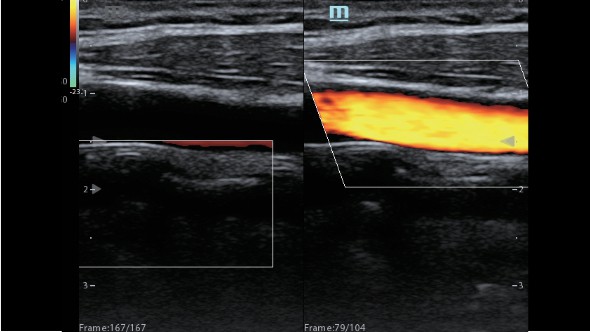 m8-ru-kv-fig3-2