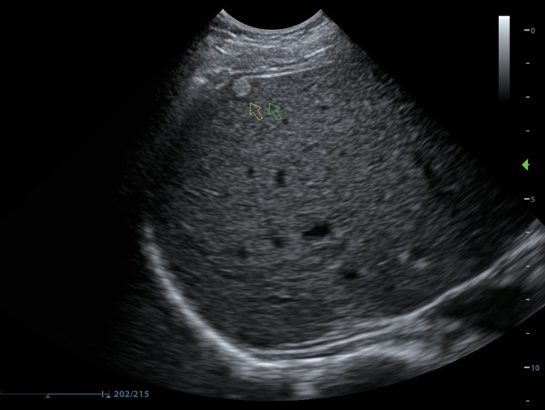 m8-ru-kv-fig5-1