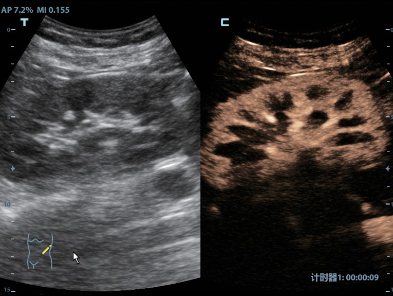 m8-ru-kv-fig5-3