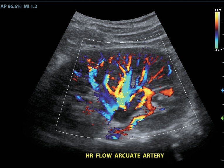 m8-ru-kv-fig5-4