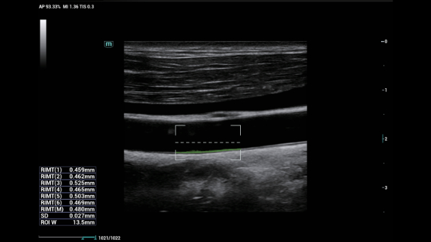 consona-cn-fig3-3-3