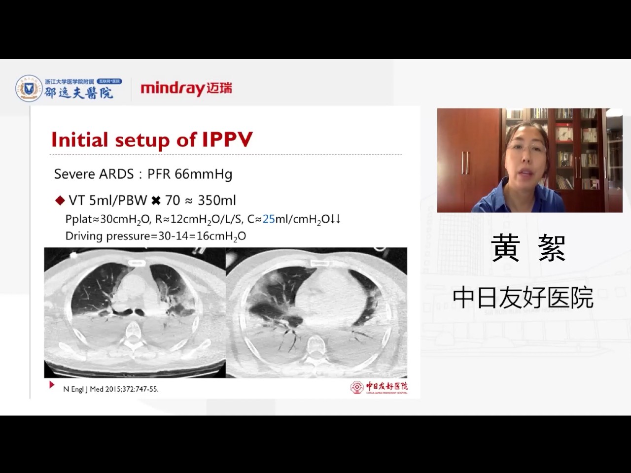 Evidence-based Invasive Respiratory Support Strategy for ARDS