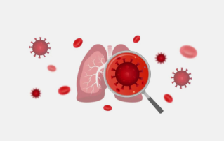 Case Study: CBC&CRP results of a critically ill COVID-19 patient