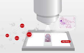 Hemabook Chapter 25: Leading the Way in Platelet Counting Innovation