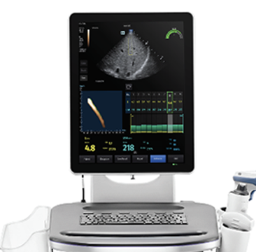 Mindray North America Is Awarded Vizient Innovative Technology Designation for its Hepatus-Series Liver Imaging Technology