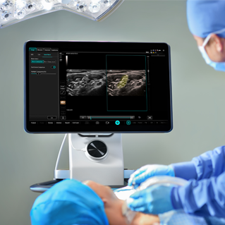 TE X Portable Ultrasound