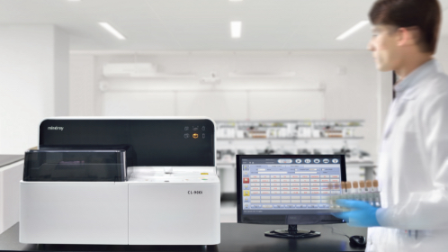 Immunoassay Chemiluminescence