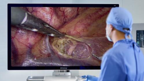 Sistema di telecamere endoscopiche