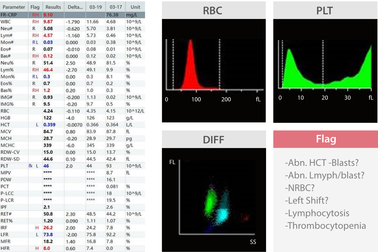 A Case Study of Acute Lymphocytic Leukemia (ALL)